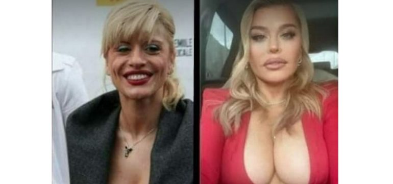 loredana groza inainte dupa