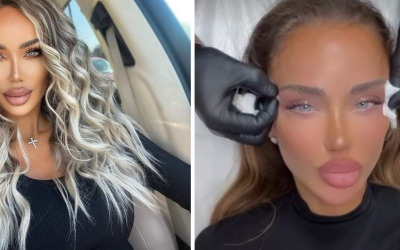 Bianca dragusanu operatii