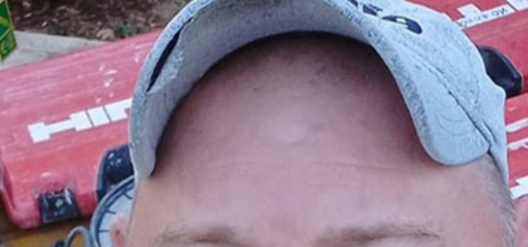 Polish_20231113_114446278