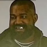 The brilliant Kanye West, who is an even greater talent than Michael Jackson, has had $850,000 worth of titanium teeth installed